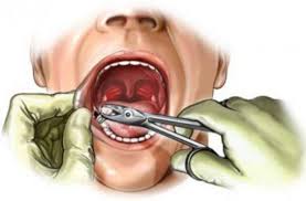 49. «Хирургическая стоматология (подготовка в поликлинике)», 36 ак.часов