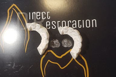 6-7 июля 2019г. !!!! ПРАКТИЧЕСКИЙ курс«DIRECT ANTERIOR, реставрация фронтальной части зубов»