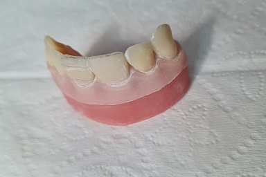 18-19 декабря Семинар:«Всё о реставрациях передних зубов. Как сделать Доступно и Красиво»